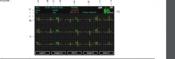 ECG Cardiomate 3